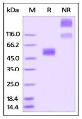 Rabbit CD47, Fc Tag on SDS-PAGE under reducing (R) and non-reducing (NR) conditions. The gel was stained overnight with Coomassie Blue. The purity of the protein is greater than 95%.